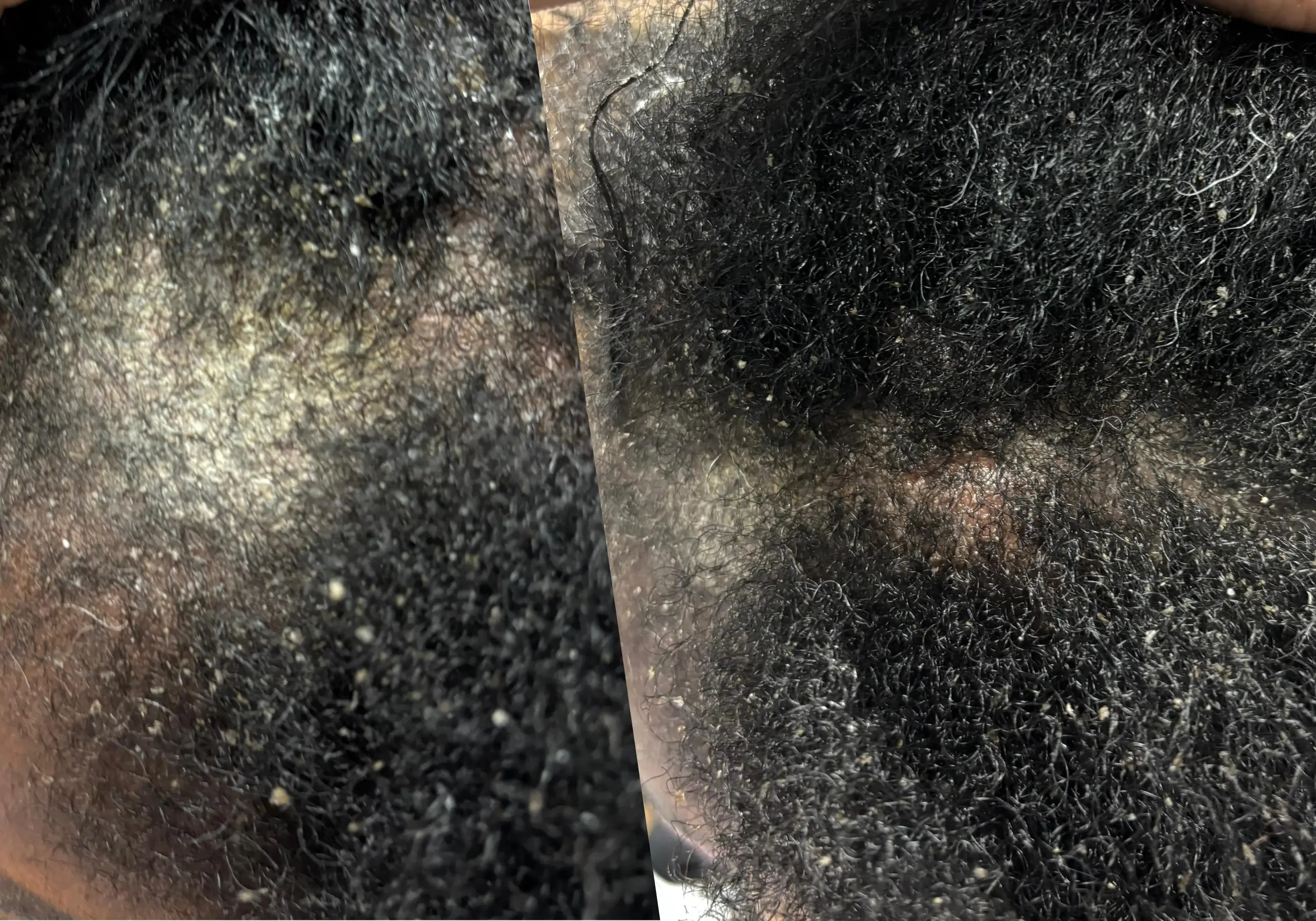 Scalp detox treatment at Wash Bar providing deep cleansing and healthy hair prep.